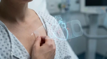 O Eco do Tratamento: Desconstruindo o Rebote do Volume Cardíaco Após a Retirada do Adesivo de Nitroglicerina