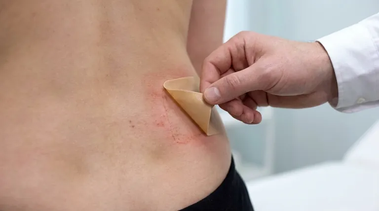 経皮オキシブチニンの一般的な適用部位反応とその対処法は?