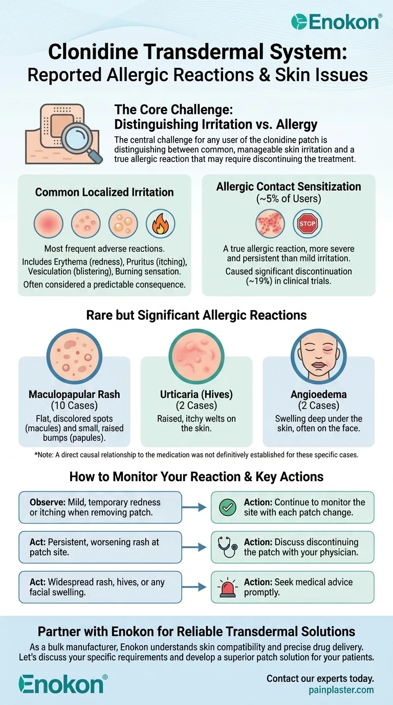 Que outras reacções alérgicas foram comunicadas em estudos clínicos com o sistema transdérmico de clonidina?Principais conclusões e informações sobre segurança Guia Visual