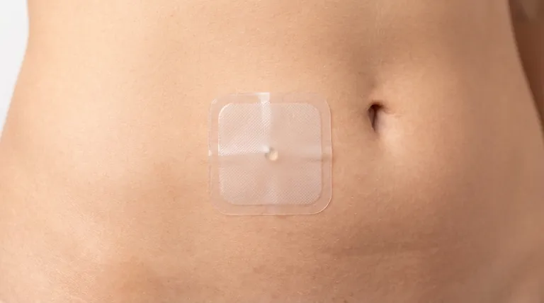 エストロゲンパッチとは何ですか?経皮HRTガイド