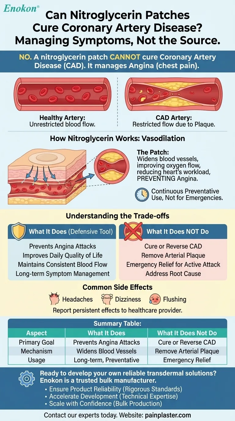 Can nitroglycerin patches cure coronary artery disease? Managing Angina, Not the Disease Visual Guide
