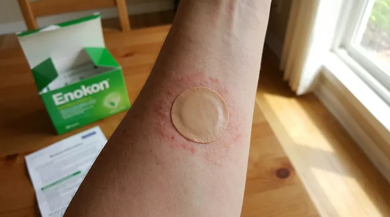 ¿Cuáles son los efectos secundarios habituales del parche?Reacciones y soluciones específicas para cada edad