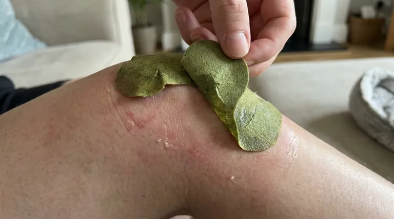 絆創膏を12時間以上貼ったままにするとどうなるか？リスクとベストプラクティス